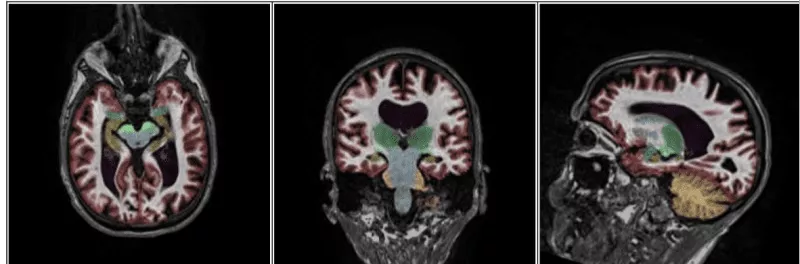 How advanced imaging strengthens personal injury cases