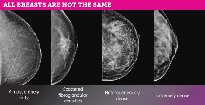 Mammography (Breast Imaging)