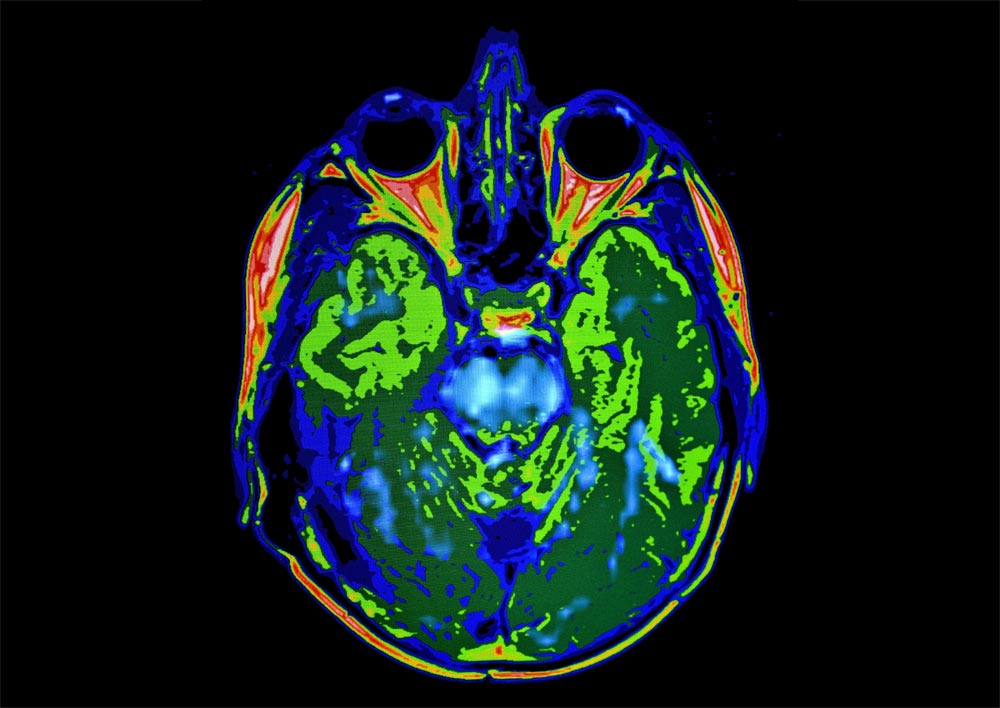 neuroradiologists2